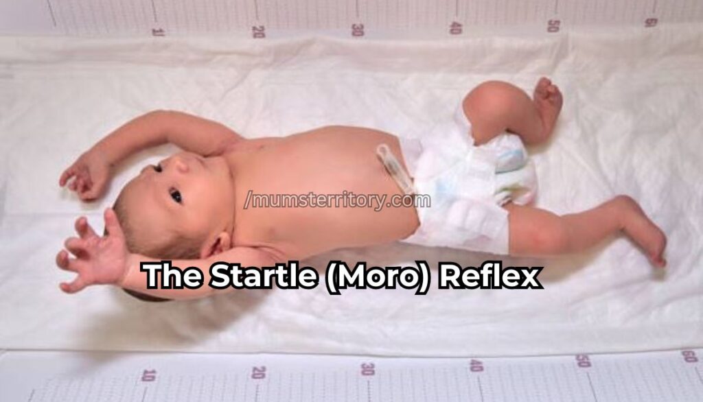 The Startle (Moro) Reflex